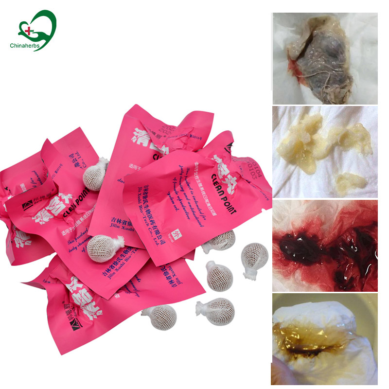 Medical Wellness & Spa Werona - 20 Buah Mutiara Yoni Titik Bersih